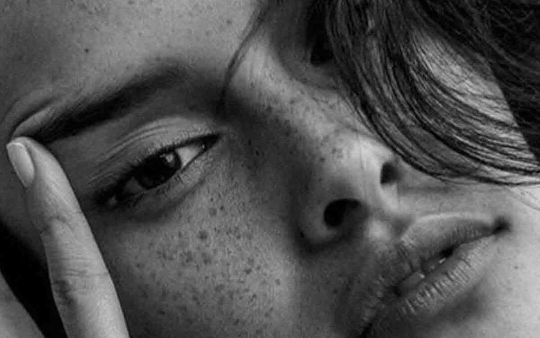 black and white cover image of the article 10 Surprising Acne Triggers You Need to Know About showing a beautiful girl
