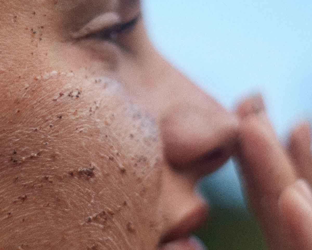 Cover picture showing a girl using enzymatic exfoliation